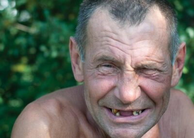 The ugly state of Kiwi oral health